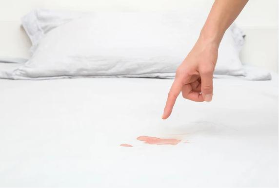 How to Get Blood Out of Bed Sheets: Solutions & Steps